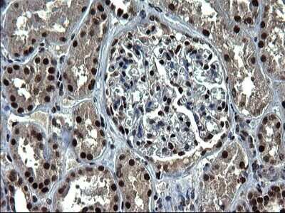 Immunohistochemistry: RPRD1B Antibody (OTI1C9) - Azide and BSA Free [NBP2-73945] - Analysis of Human Kidney tissue. (Heat-induced epitope retrieval by 1 mM EDTA in 10mM Tris, pH8.5, 120C for 3min)