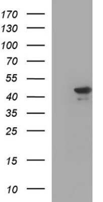 Western Blot: RPRD1B Antibody (OTI1C9) - Azide and BSA Free [NBP2-73945] - Analysis of HEK293T cells were transfected with the pCMV6-ENTRY control (Left lane) or pCMV6-ENTRY RPRD1B.