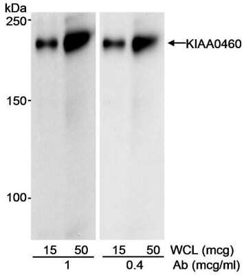 Western Blot: RPRD2 Antibody [NBP1-97932] - Whole cell lysate (15 and 50 ug) from HEK293 cells. Antibody: Affinity purified goat anti-KIAA0460 antibody used at 1 and 0.4 ug/ml. Detection: Chemiluminescence with an exposure time of 1 minute.