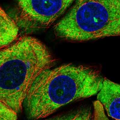 Immunocytochemistry/Immunofluorescence: RPS11 Antibody [NBP2-13262] - Staining of human cell line MCF7 shows localization to nucleoli, cytosol & endoplasmic reticulum.