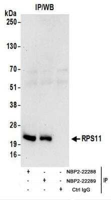 Immunoprecipitation: RPS11 Antibody [NBP2-22289] - Whole cell lysate (1 mg for IP; 20% of IP loaded) from 293T cells.  Antibodies:  Affinity purified rabbit anti-RPS11 antibody NBP2-22289 used for IP at 6 ug/mg lysate.  RPS11 was also immunoprecipitated by rabbit anti-RPS11 antibody NBP2-22288.  For blotting immunoprecipitated RPS11, NBP2-22289 was used at 0.4 ug/ml.  Detection: Chemiluminescence with an exposure time of 30 seconds.