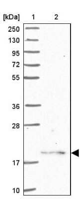 Western Blot: RPS11 Antibody [NBP2-13262] - Lane 1: Marker [kDa] 250, 130, 95, 72, 55, 36, 28, 17, 10Lane 2: Human cell line RT-4