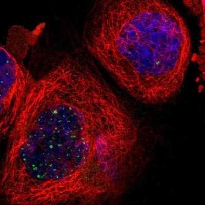 Immunocytochemistry/Immunofluorescence: RPS13 Antibody [NBP1-92350] - Immunofluorescent staining of human cell line A-431 shows localization to nuclear bodies.