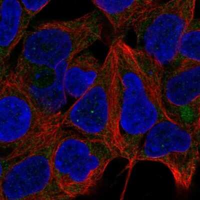 Immunocytochemistry/Immunofluorescence: RPS13 Antibody [NBP1-92350] - Staining of human cell line HEK 293 shows localization to endoplasmic reticulum.