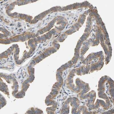 Immunohistochemistry-Paraffin: RPS14 Antibody [NBP1-84847] - Staining of human Fallopian tube shows weak to moderate cytoplasmic positivity in glandular cells.