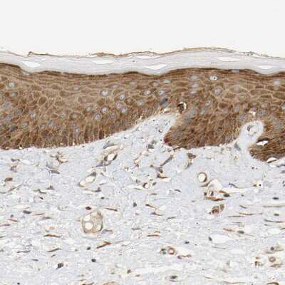 Immunohistochemistry-Paraffin: RPS14 Antibody [NBP1-84847] - Staining of human skin shows moderate cytoplasmic positivity in squamous epithelial cells.