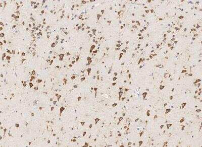 Immunohistochemistry-Paraffin: RPS14 Antibody [NBP3-12555] - Staining of human RPS14 in human brain with rabbit polyclonal antibody at 1:200 dilution.