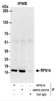 <b>Biological Strategies Validation. </b>Immunoprecipitation: RPS14 Antibody [NBP2-22319] - Whole cell lysate (1 mg for IP; 20% of IP loaded) from 293T cells.  Antibodies:  NBP2-22319 used for IP at 6 ug/mg lysate.  RPS14 was also immunoprecipitated by rabbit anti-RPS14 antibody.  For blotting immunoprecipitated RPS14, NBP2-22319 was used at 1 ug/ml.  Detection: Chemiluminescence with an exposure time of 10 seconds.