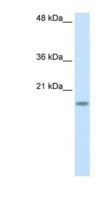 Western Blot: RPS14 Antibody [NBP1-57365] - Titration: 2.5ug/ml, Positive Control: HepG2 cell lysate.