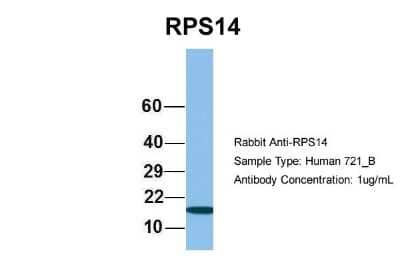 Western Blot: RPS14 Antibody [NBP1-57365] - Analysis of 721_B cell lysate. Antibody Dilution: 1.0 ug/ml RPS14 is strongly supported by BioGPS gene expression data to be expressed in Human 721_B cells.