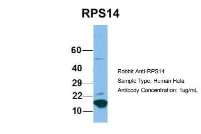 Western Blot: RPS14 Antibody [NBP1-57365] - Hela, Antibody Dilution: 1.0 ug/ml RPS14 is supported by BioGPS gene expression data to be expressed in HeLa.