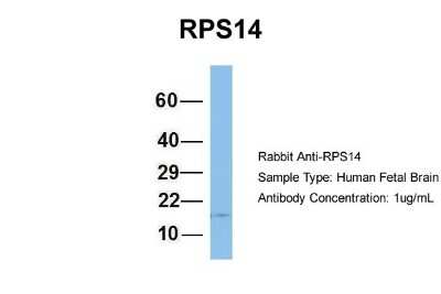 Western Blot: RPS14 Antibody [NBP1-57365] - Human Fetal Brain, Antibody Dilution: 1.0 ug/ml.