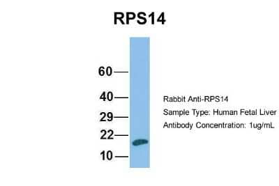 Western Blot: RPS14 Antibody [NBP1-57365] - Human Fetal Liver, Antibody Dilution: 1.0 ug/ml.