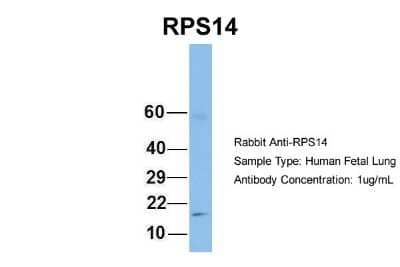 Western Blot: RPS14 Antibody [NBP1-57365] - Human Fetal Lung, Antibody Dilution: 1.0 ug/ml.