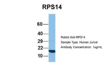 Western Blot: RPS14 Antibody [NBP1-57365] - Jurkat, Antibody Dilution: 1.0 ug/ml RPS14 is supported by BioGPS gene expression data to be expressed in Jurkat.