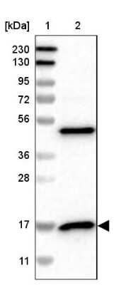 Western Blot: RPS14 Antibody [NBP1-84847] - Lane 1: Marker [kDa] 230, 130, 95, 72, 56, 36, 28, 17, 11Lane 2: Human cell line RT-4