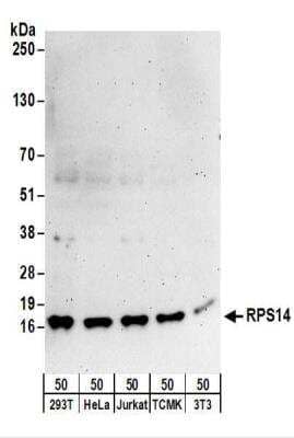 Western Blot: RPS14 Antibody [NBP2-22319] - Whole cell lysate (50 ug) from 293T, HeLa, Jurkat, mouse TCMK-1, and mouse NIH3T3 cells. NBP2-22319 used for WB at 0.1 ug/ml.  Detection: Chemiluminescence with an exposure time of 3 minutes.