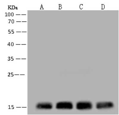 Western Blot: RPS14 Antibody [NBP3-12555] - Anti-RPS14 rabbit polyclonal antibody at 1:500 dilution.