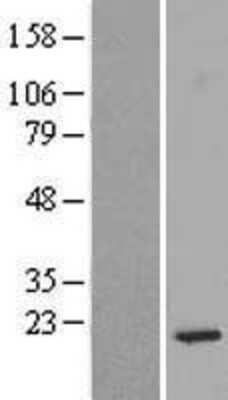 Western Blot: RPS14 Overexpression Lysate (Adult Normal) [NBL1-15559] Left-Empty vector transfected control cell lysate (HEK293 cell lysate); Right -Over-expression Lysate for RPS14.