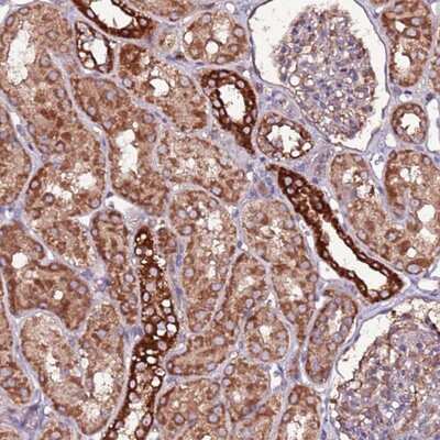 Immunohistochemistry-Paraffin RPS15A Antibody