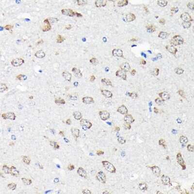 Immunohistochemistry-Paraffin: RPS15A Antibody [NBP2-93348] - Immunohistochemistry of paraffin-embedded mouse brain using RPS15A Rabbit pAb (NBP2-93348) at dilution of 1:200 (40x lens). Perform high pressure antigen retrieval with 10 mM citrate buffer pH 6.0 before commencing with IHC staining protocol.