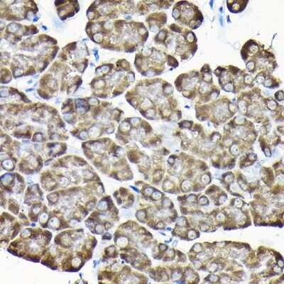 Immunohistochemistry-Paraffin: RPS15A Antibody [NBP2-93348] - Immunohistochemistry of paraffin-embedded mouse pancreas using RPS15A Rabbit pAb (NBP2-93348) at dilution of 1:200 (40x lens). Perform high pressure antigen retrieval with 10 mM citrate buffer pH 6.0 before commencing with IHC staining protocol.