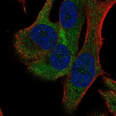 Immunocytochemistry/Immunofluorescence: RPS18 Antibody [NBP2-55001] - Staining of human cell line SK-MEL-30 shows localization to cytosol.