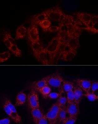 Immunocytochemistry/Immunofluorescence: RPS18 Antibody [NBP2-93632] - Analysis of HepG2 cells using RPS18 Rabbit pAb at dilution of 1:250 (40x lens). Blue: DAPI for nuclear staining.