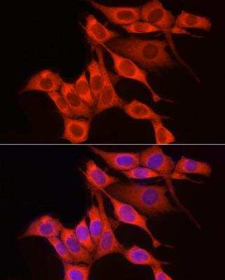 Immunocytochemistry/Immunofluorescence: RPS18 Antibody [NBP2-93632] - Analysis of NIH/3T3 cells using RPS18 Rabbit pAb at dilution of 1:250 (40x lens). Blue: DAPI for nuclear staining.