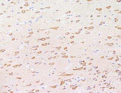 Immunohistochemistry-Paraffin: RPS18 Antibody [NBP3-12554] - Staining of human RPS18 in human brain with rabbit polyclonal antibody at 1:100 dilution.