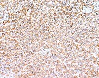 Immunohistochemistry-Paraffin: RPS18 Antibody [NBP3-12554] - Staining of human RPS18 in human liver with rabbit polyclonal antibody at 1:100 dilution.