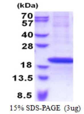 SDS-Page: RPS18 Protein [NBP2-23431]