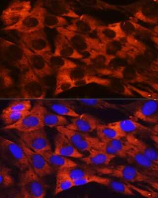 Immunocytochemistry/Immunofluorescence: RPS19 Antibody (4V3S7) [NBP3-16244] - Immunofluorescence analysis of C6 cells using RPS19 Rabbit mAb (NBP3-16244) at dilution of 1:100 (40x lens). Blue: DAPI for nuclear staining.