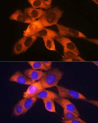 Immunocytochemistry/Immunofluorescence: RPS19 Antibody (4V3S7) [NBP3-16244] - Immunofluorescence analysis of NIH-3T3 cells using RPS19 Rabbit mAb (NBP3-16244) at dilution of 1:100 (40x lens). Blue: DAPI for nuclear staining.