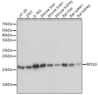 Western Blot: RPS19 Antibody (4V3S7) [NBP3-16244] - Western blot analysis of extracts of various cell lines, using RPS19 Rabbit mAb (NBP3-16244) at 1:1000 dilution. Secondary antibody: HRP Goat Anti-Rabbit IgG (H+L) at 1:10000 dilution. Lysates/proteins: 25ug per lane. Blocking buffer: 3% nonfat dry milk in TBST. Detection: ECL Basic Kit. Exposure time: 1s.