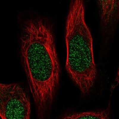 Immunocytochemistry/Immunofluorescence: RPS19 Antibody [NBP2-68805] - Staining of human cell line U-2 OS shows localization to nucleoplasm.