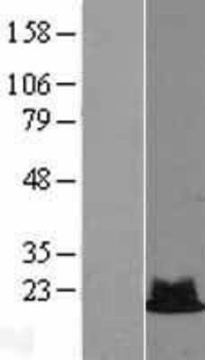 Western Blot: RPS19 Overexpression Lysate (Adult Normal) [NBL1-15564] Left-Empty vector transfected control cell lysate (HEK293 cell lysate); Right -Over-expression Lysate for RPS19.