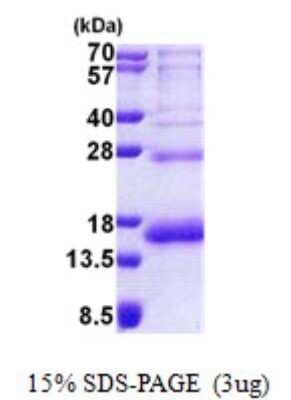 SDS-Page: RPS19 Protein [NBP2-23432]