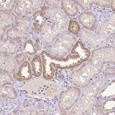 Immunohistochemistry-Paraffin: RPS2 Antibody [NBP2-47295] - Staining of human kidney shows moderate cytoplasmic positivity in cells in tubules.
