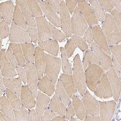 Immunohistochemistry-Paraffin: RPS2 Antibody [NBP2-47295] - Staining of human skeletal muscle shows weak cytoplasmic positivity in myocytes.