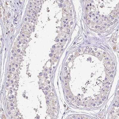 Immunohistochemistry-Paraffin: RPS2 Antibody [NBP2-47295] - Staining of human testis shows very weak positivity in cells in seminiferous ducts.