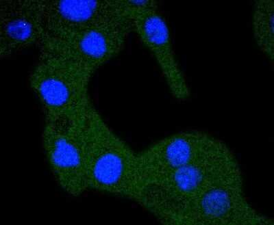 Immunocytochemistry/Immunofluorescence: RPS20 Antibody (SC65-08) [NBP2-67628] - ICC staining RPS20 in B16-F1 cells (green). The nuclear counter stain is DAPI (blue). Cells were fixed in paraformaldehyde, permeabilized with 0.25% Triton X100/PBS.