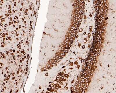 Immunohistochemistry-Paraffin: RPS20 Antibody (SC65-08) [NBP2-67628] - Analysis of paraffin-embedded mouse hippocampus tissue with Rabbit anti-RPS20 antibody washed with ddH2O and PBS, and then probed with the primary antibody  at 1/200 dilution for 1 hour at room temperature. The detection was performed using an HRP conjugated compact polymer system. DAB was used as the chromogen. Tissues were counterstained with hematoxylin and mounted with DPX.