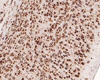 Immunohistochemistry-Paraffin: RPS20 Antibody (SC65-08) [NBP2-67628] - Analysis of paraffin-embedded mouse brain tissue with Rabbit anti-RPS20 antibody washed with ddH2O and PBS, and then probed with the primary antibody  at 1/200 dilution for 1 hour at room temperature. The detection was performed using an HRP conjugated compact polymer system. DAB was used as the chromogen. Tissues were counterstained with hematoxylin and mounted with DPX.