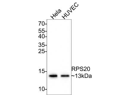Western Blot: RPS20 Antibody (SC65-08) [NBP2-67628] - Analysis of RPS20 on different lysates with Rabbit anti-RPS20 antibody at 1/500 dilution. Lane 1: Hela cell lysate Lane 2: HUVEC cell lysate Lysates/proteins at 10 ug/Lane. Predicted band size: 13 kDa Observed band size: 13 kDa Exposure time: 2 minutes; 15% SDS-PAGE gel. Proteins were transferred to a PVDF membrane and blocked with 5% NFDM/TBST for 1 hour at room temperature. The primary antibody at 1/500 dilution was used in 5% NFDM/TBST at room temperature for 2 hours. Goat Anti-Rabbit IgG - HRP Secondary Antibody at 1:300,000 dilution was used for 1 hour at room temperature.