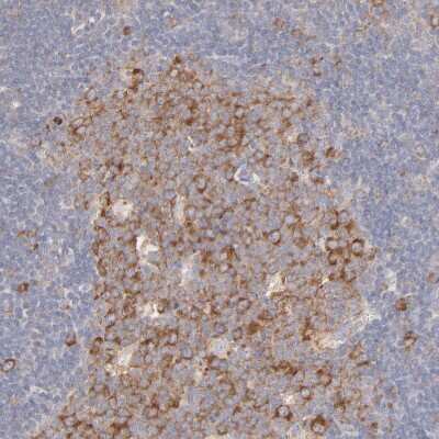 Immunohistochemistry-Paraffin RPS21 Antibody