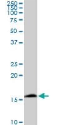 Western Blot: RPS23 Antibody (1E3) [H00006228-M02] - RPS23 monoclonal antibody (M02), clone 1E3. Analysis of RPS23 expression in PC-12.