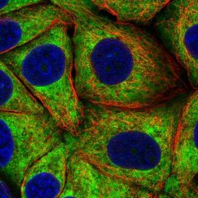 Immunocytochemistry/Immunofluorescence: RPS23 Antibody [NBP2-30412] - Immunofluorescent staining of human cell line MCF7 shows localization to cytosol & endoplasmic reticulum. Antibody staining is shown in green.