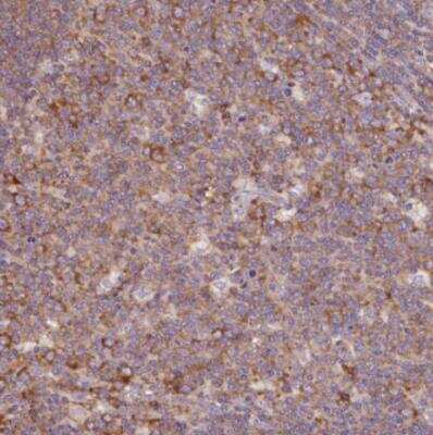 Immunohistochemistry-Paraffin RPS23 Antibody