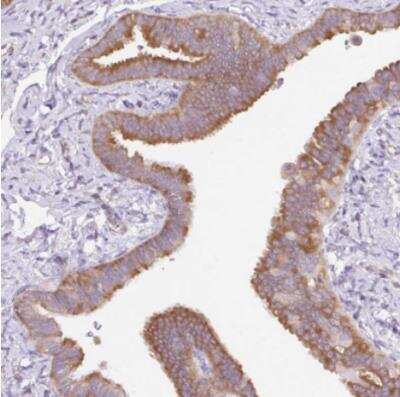 Immunohistochemistry-Paraffin RPS23 Antibody